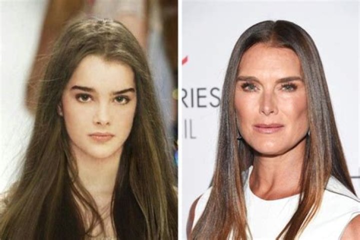 [News] Brooke Shields before and after weight loss: Is she sick now? Brooke Shields’ Weight Loss Journey